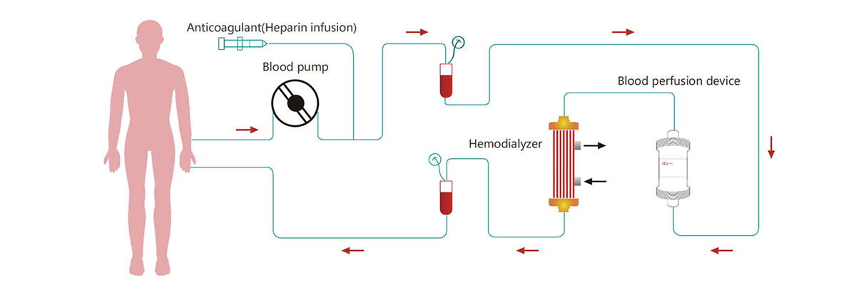 How Disposable Hemoperfutor Works